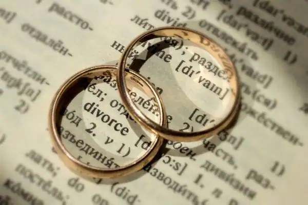 Image of rings removed before divorce mediation Brentwood